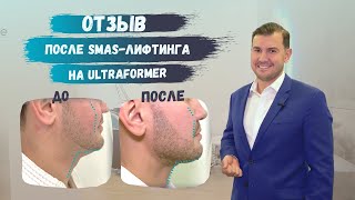 : Smas-  ULTRAFORMER |      