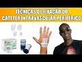 COMO FIXAR UM CATETER INTRAVASCULAR PERIFÉRICO