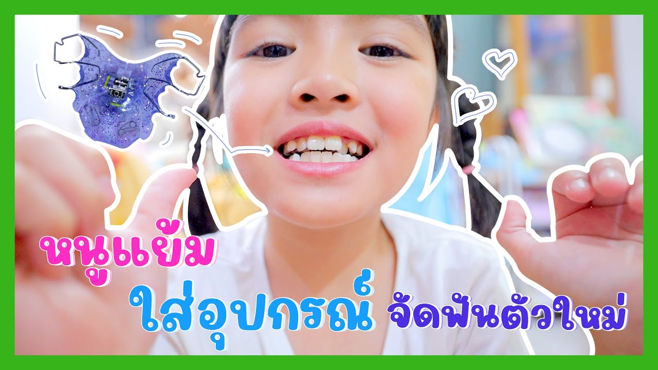 YimYamFamily | หนูแย้มใส่อุปกรณ์จัดฟันตัวใหม่