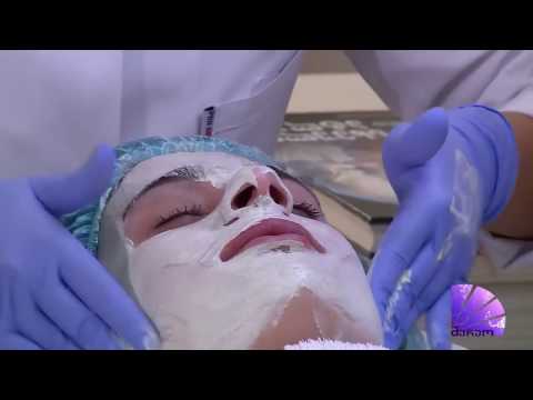 აკნეს საწინააღმდეგო უნემსო მეზოთერაპია