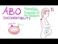 ABO Incompatibility And Hemolytic Disease Of The Newborn (HDN)