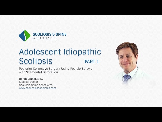 Part 1 Scoliosis Surgery Video - Adolescent Idiopathic Scoliosis