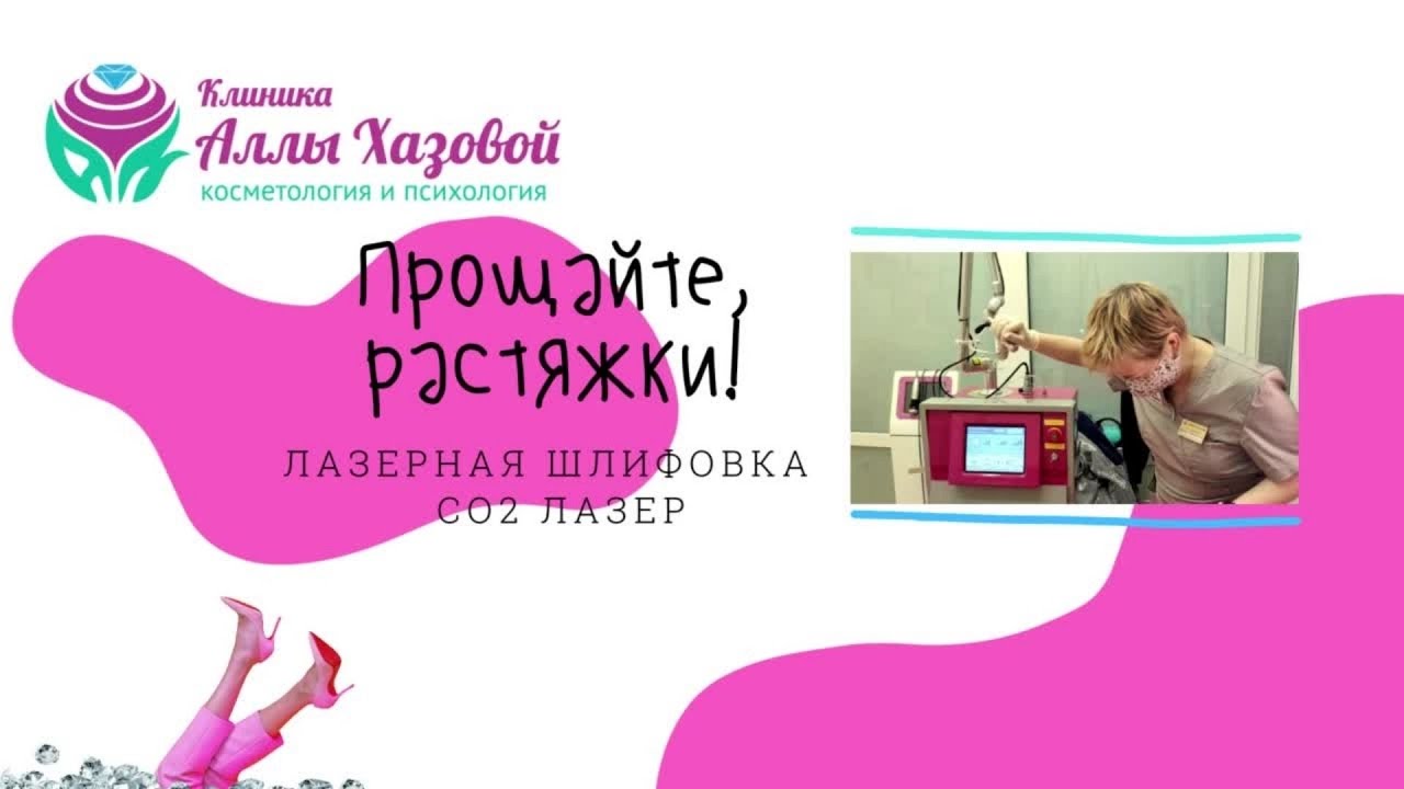 Прощайте, растяжки! СО2 лазер и борьба с растяжками и стриями - YouTube