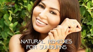 Natural Home Remedies for Sunburns | 5 Natural Ways To Soothe Sunburn