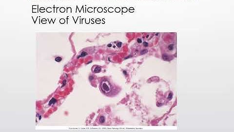 FON Chapter 16 Recording