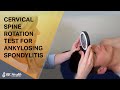 Cervical Spine Rotation Test for Ankylosing Spondylitis