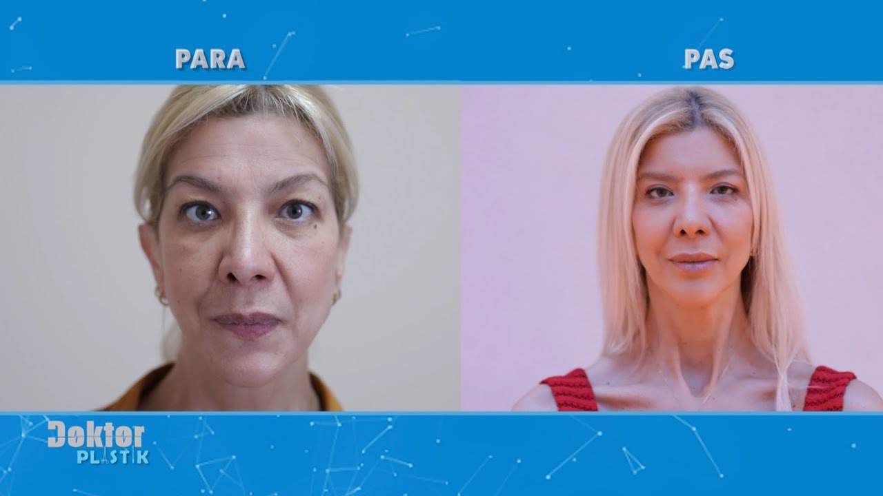 Me fytyren si 10 vjet me pare. Transformimi natyral i gruas ne Doktor Plastik dhe Spitalin Amerikan