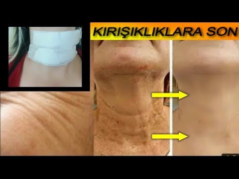 Video: Boyun çizgisinden Göbeğe Kadar Olan Akinshina, çocukları Sınıflandırdı