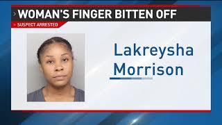 Police arrest woman accused of biting off someone's finger