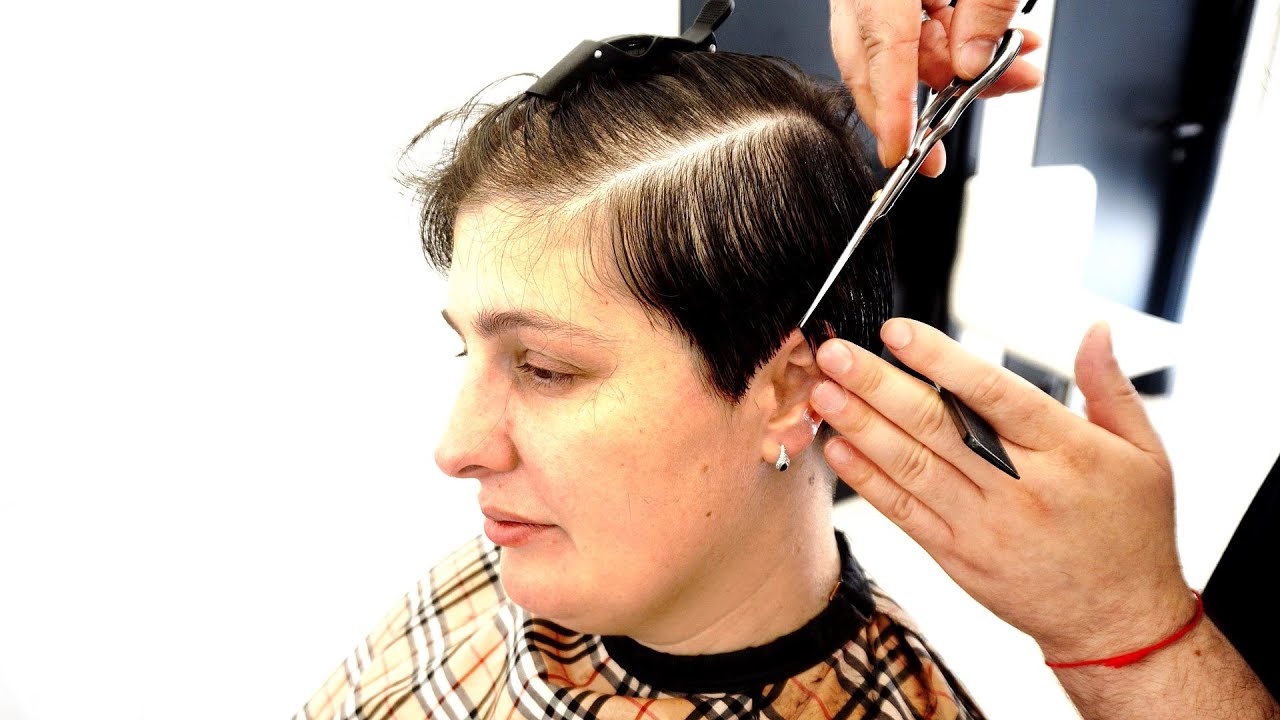 Female Pattern Baldness - Hair Loss in Women - Harley Street HTC