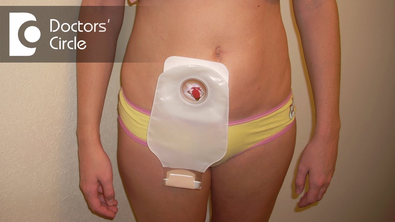 Colo-Majic Liners® Flushable Ostomy Pouch Liners | Ostomy Accessories