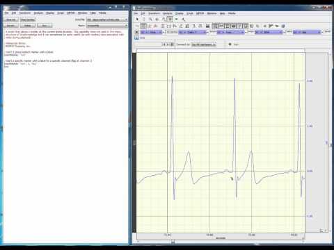 Scripting - place marker at index