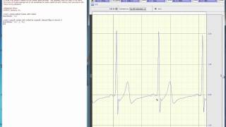 Scripting - place marker at index