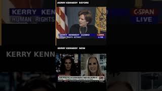 Familial Spasmodic Dysphonia and the Kennedy Family: A Case Study in Genetic Susceptibility and Vac