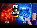 Feeling Inflamed? Fix Your Gut to Feel Better Fast | Dr. Mandell