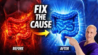 Feeling Inflamed? Fix Your Gut to Feel Better Fast | Dr. Mandell