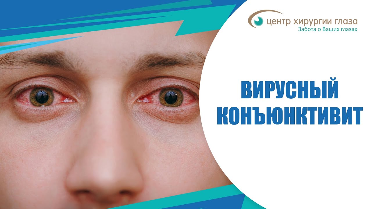 Око центр зрения краснодар Око центр зрения краснодар