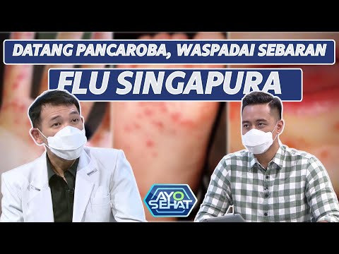 Flu Singapura pada Anak, Harus Apa? | AYO SEHAT