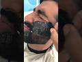 Waxing treatment