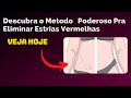 estrias vermelhas tratamento