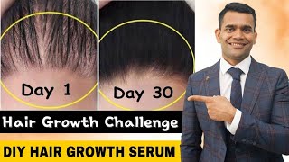 Powerful Hair Growth Serum For Extreme Hair Growth | Regrow Lost Hair Get Double Density in 30 days screenshot 3