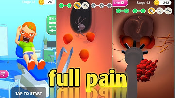 Earwax clinic | ear pain save me | please treatment#experimentshow #dakoi