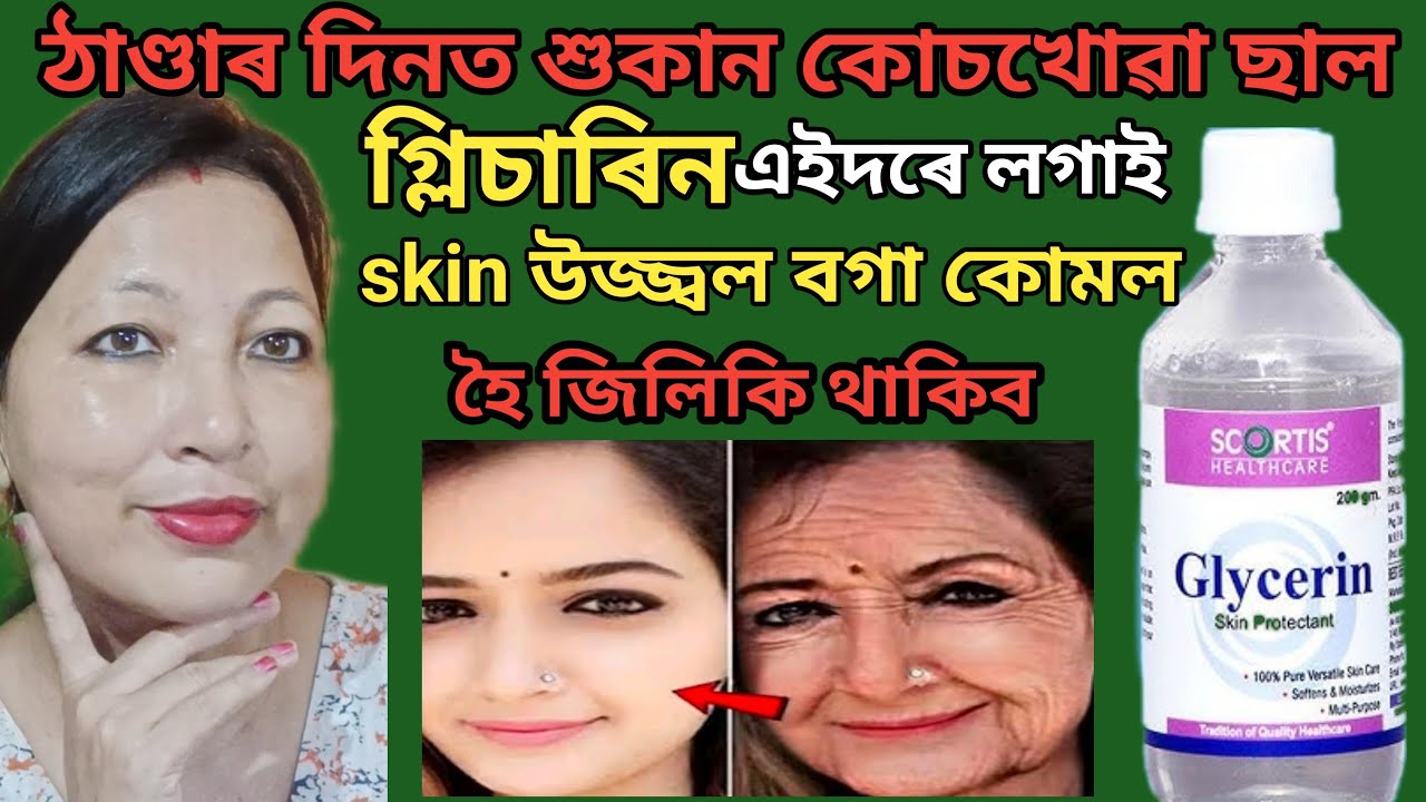 ঠাণ্ডাৰ দিনত শুকান কোচখোৱা ছাল Glycerine এইদৰে লগাই skin বগা উজ্বল কোমল হৈ জিলিকি থাকিব | vlog 