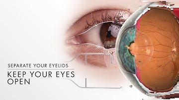 Intravitreal Injections  Overview
