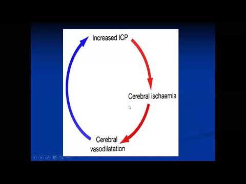 Cidera Kepala - dr. M. Yunus, Sp.BS