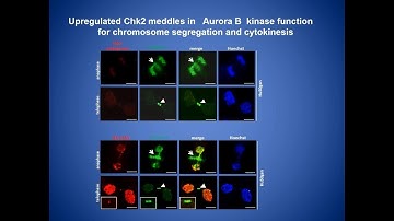 CHK2, chromosomal instability, and hepatocellular carcinoma progression