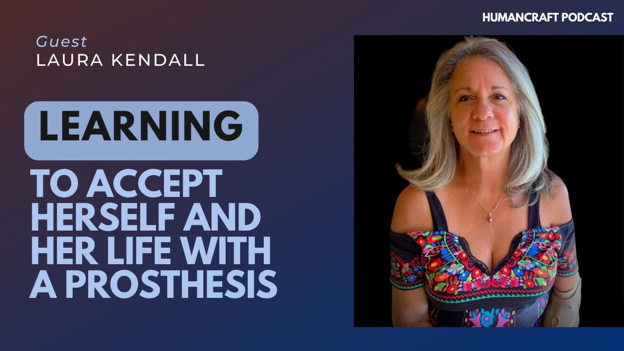 Life with a Prosthesis and Learning to Accept Oneself