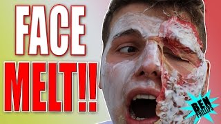 My bro's FACE scarred for life! **PRANK!**