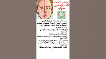اعراض جلطه المخ قبل حدوثها الجلطه الدماغية 