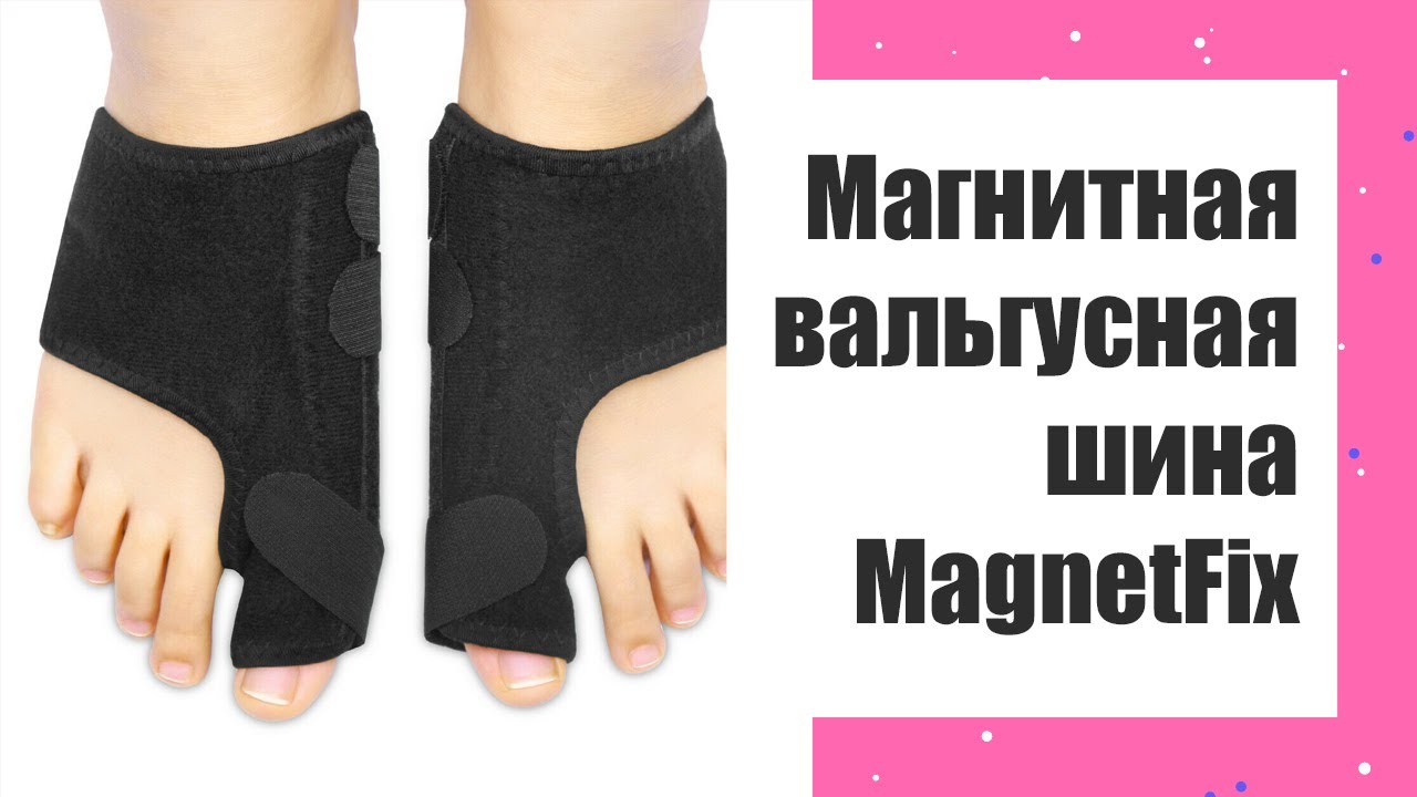 🤕 Корректор вальгусной деформации большого пальца стопы 🔵 Вальгусная шина немецкая 🔴
