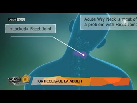 Video: Cum Se Repară Un Nerv Ciupit în Gât - Cauze, Simptome și Remedii