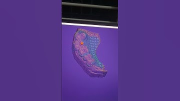 exocad cast partial denture design 🦷#exocad #castpartialdenture #design