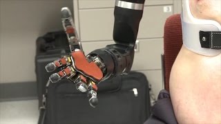 Tomorrow Daily - 103: Man's bionic arms make history, NASA proposes cloud cities on Venus and more