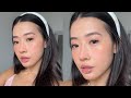 My Rhinoplasty Journey (4 weeks post surgery)