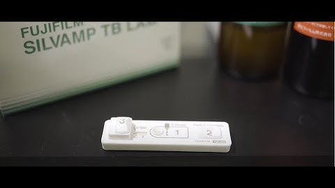 Prueba rápida de Tuberculosis LAM | GHIT Fund TB LAM test