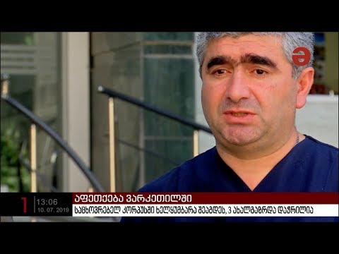 ვარკეთილში, ერთ-ერთ საცხოვრებელ კორპუსში ხელყუმბარა შეაგდეს, დაშავებულია სამი ადამიანი