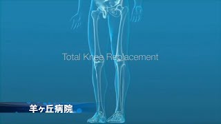 羊ヶ丘病院様　Dr H kura TKA手術映像＜サンプル版＞