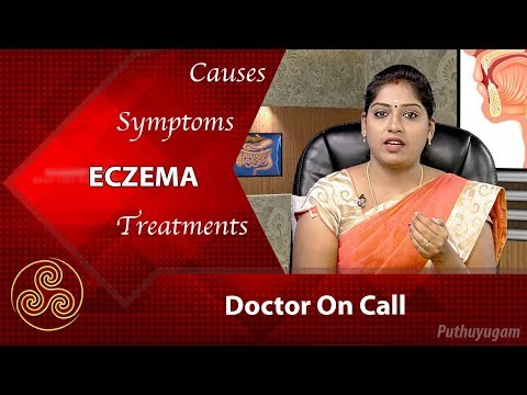 Eczema: Symptoms, treatment, and causes | Doctor On Call | 29/01/2018