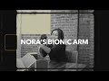 Nora&#39;s Bionic Arm