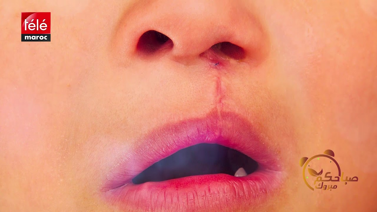 ‫هذه مسببات التشوهات الخلقية لدى الرضع‬