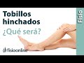 ¿Tienes los tobillos y piernas hinchadas? - ¿Será edema venoso o linfático?