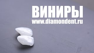 Виниры на зубы(Виниры на зубы – это микропротезы, которые обладают эстетичным внешним видом и отличными рабочими качеств..., 2015-01-05T23:59:46.000Z)