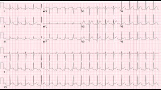 Pediatric Cardiology-I