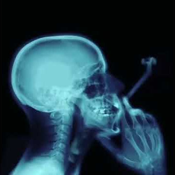 Akibat menghisap rokok, asapnya menyebar sampai ke otak