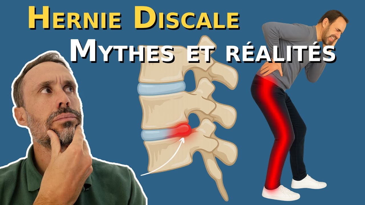 HERNIE DISCALE : Ce qu’on ne vous dit pas !