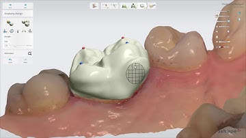 3Shape TRIOS Design Studio - 設計ツール